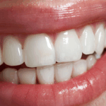 Các bước cơ bản để duy trì răng khỏe và trắng